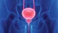 آشنایی با سرطان مثانه (Bladder Cancer)