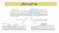 «روزه داری و سرطان»